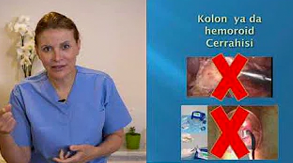 Kolon ve Rektum Kanseri